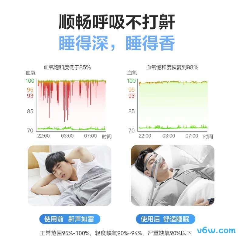 乐普R20呼吸机图片