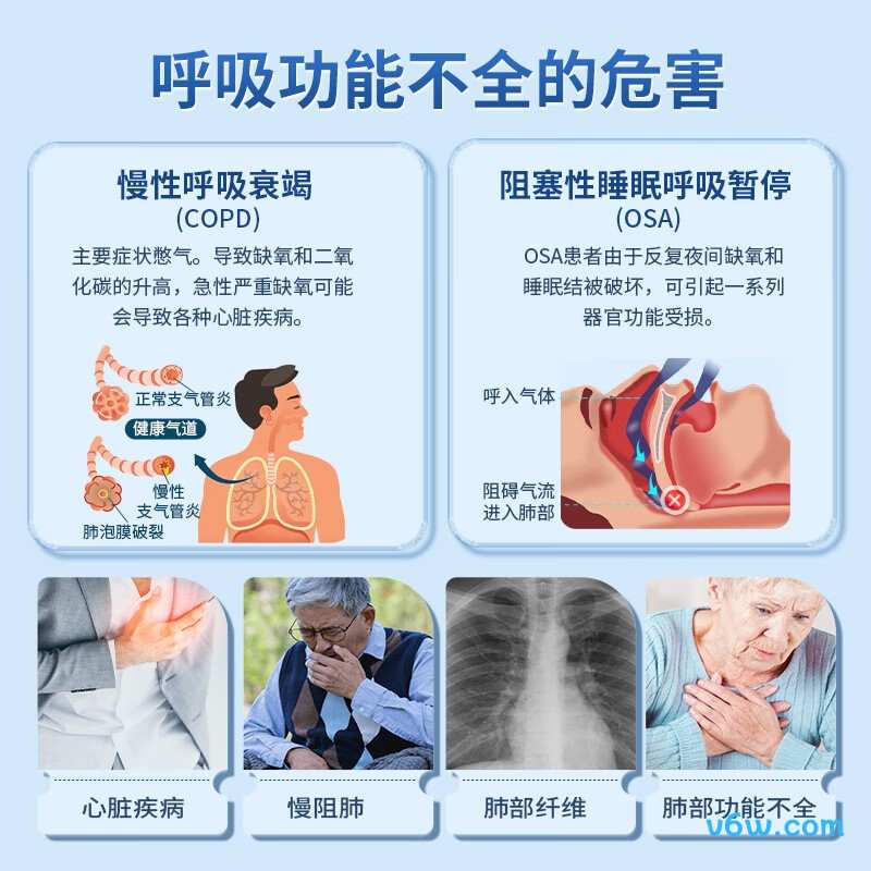 飞利浦ST30呼吸机图片