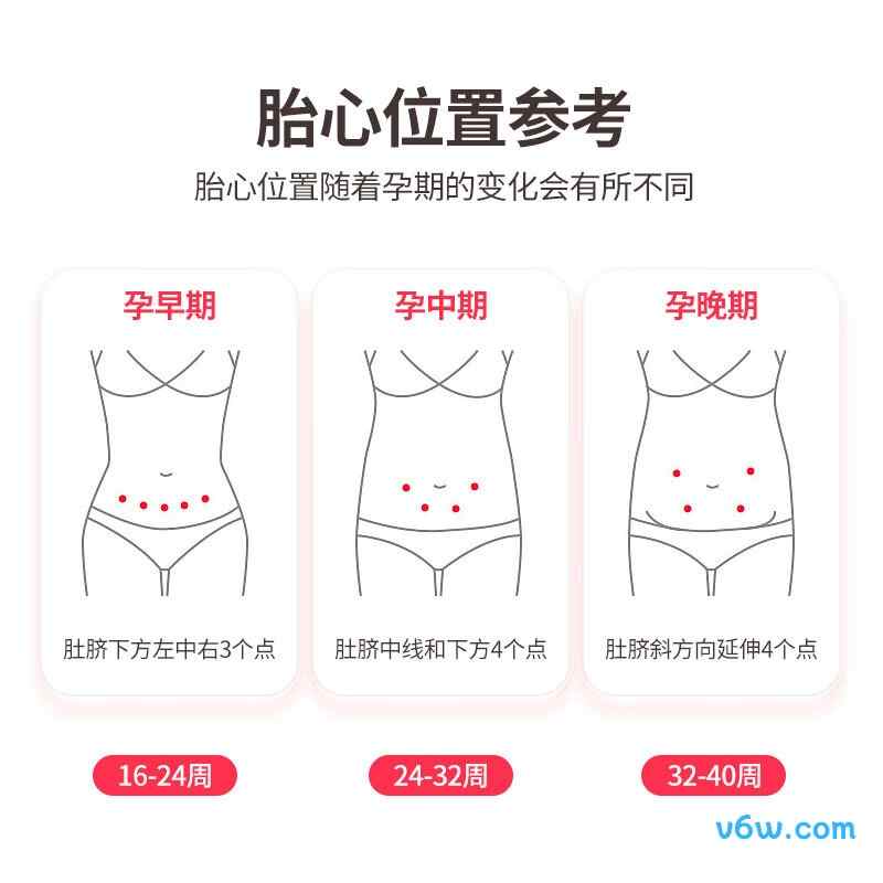 CONTECSonoline A胎心仪图片