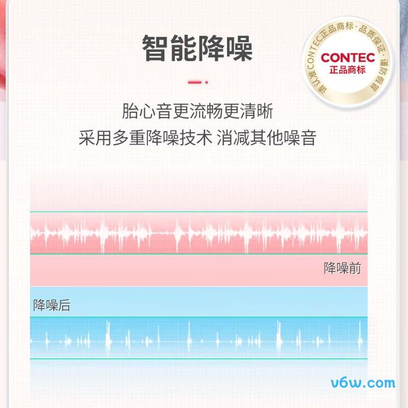 CONTEC-10D（蓝牙款）胎心仪图片