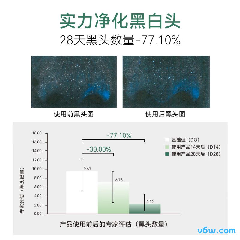 安修泽水杨酸涂抹泥膜涂抹面膜图片