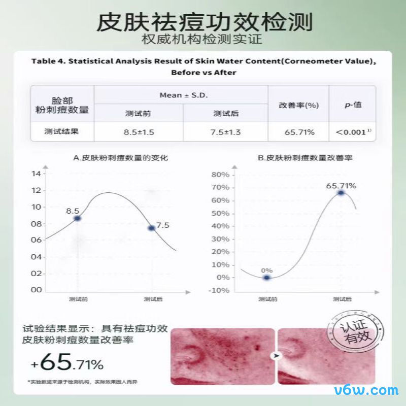 儒意水杨酸面膜贴片面膜图片