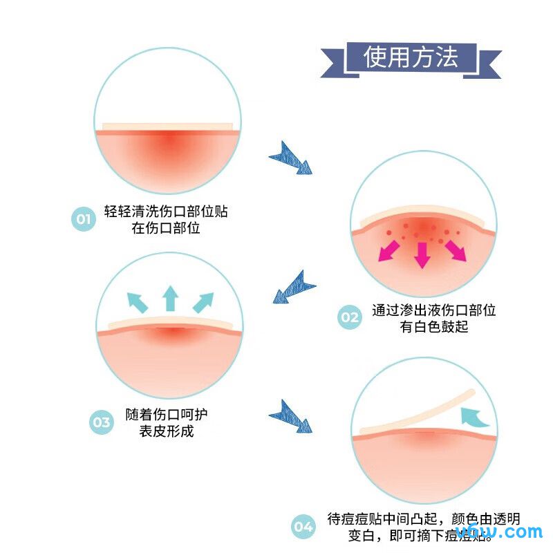 欧利芙洋隐形痘痘贴贴片面膜图片